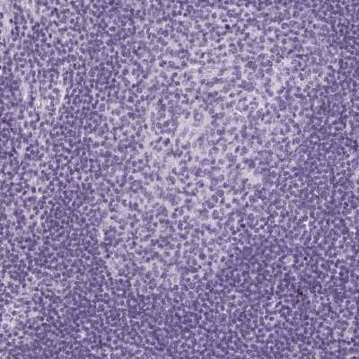Immunohistochemistry-Paraffin: LRP2 Antibody [NBP2-39033]