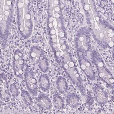Immunohistochemistry-Paraffin: LRP2 Antibody [NBP2-39033]