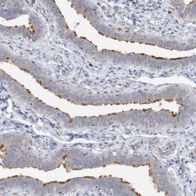 Immunohistochemistry-Paraffin: LRP2BP Antibody [NBP1-84096]