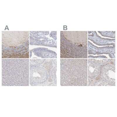 Immunohistochemistry-Paraffin: LRP2BP Antibody [NBP1-84097]