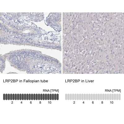 Immunohistochemistry-Paraffin: LRP2BP Antibody [NBP1-84097]