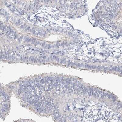 Immunohistochemistry-Paraffin: LRP2BP Antibody [NBP1-84097]