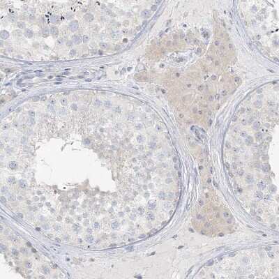 Immunohistochemistry-Paraffin: LRP2BP Antibody [NBP1-84097]