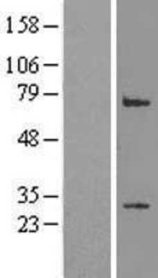 Western Blot: LRP2BP Overexpression Lysate [NBP2-06807]