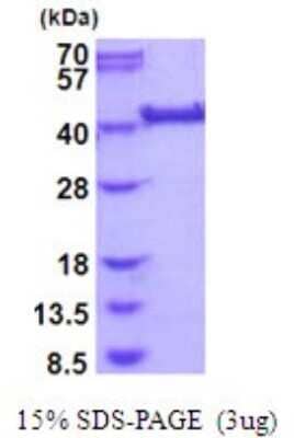 SDS-PAGE: Recombinant Human LRP2BP His Protein [NBP2-51978]