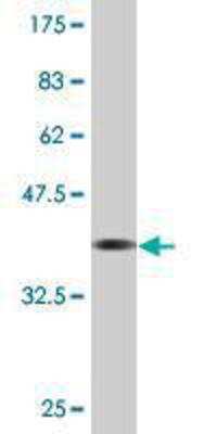 Western Blot: LRP3 Antibody (4C11) [H00004037-M10]