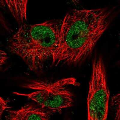 Immunocytochemistry/ Immunofluorescence: LRP5L Antibody [NBP1-90543]