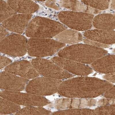 Immunohistochemistry-Paraffin: LRP5L Antibody [NBP1-90543]