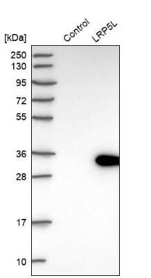 Western Blot: LRP5L Antibody [NBP1-90543]