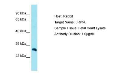 Western Blot: LRP5L Antibody [NBP2-83148]