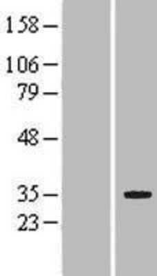 Western Blot: LRP5L Overexpression Lysate [NBP2-04856]