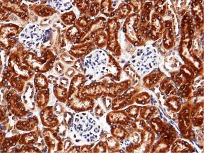 Immunohistochemistry-Paraffin: LRPAP Antibody (009) [NBP2-90513]