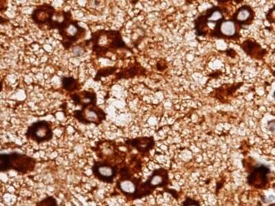 Immunohistochemistry-Paraffin: LRPAP Antibody (009) [NBP2-90513]