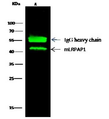 Immunoprecipitation: LRPAP Antibody (009) [NBP2-90513]