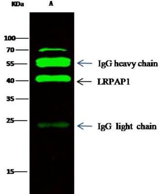 Immunoprecipitation: LRPAP Antibody (4) [NBP2-89796]