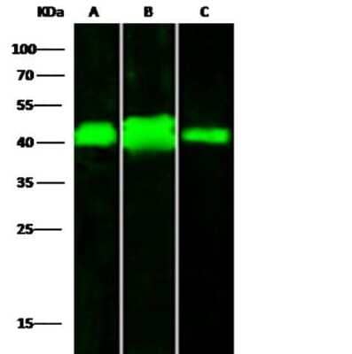 Western Blot: LRPAP Antibody (4) [NBP2-89796]