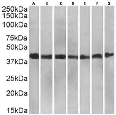 Western Blot: LRPAP Antibody (7F1)ChimericAzide and BSA Free [NBP3-12047]