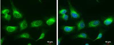 Immunocytochemistry/ Immunofluorescence: LRPAP Antibody [NBP2-15088]