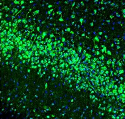 Immunohistochemistry: LRPAP Antibody [NBP1-89334]