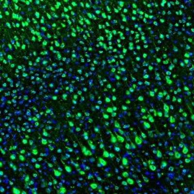 Immunohistochemistry: LRPAP Antibody [NBP1-89334]