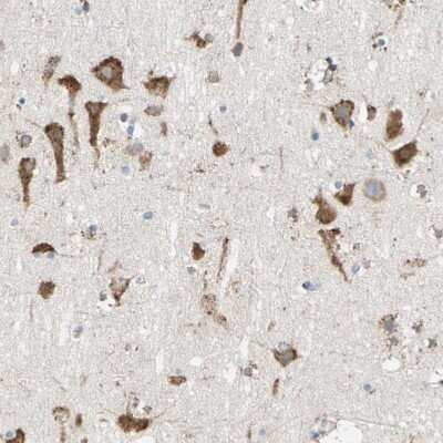 Immunohistochemistry-Paraffin: LRPAP Antibody [NBP1-89334]