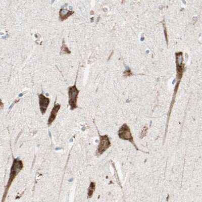 Immunohistochemistry-Paraffin: LRPAP Antibody [NBP1-89334]