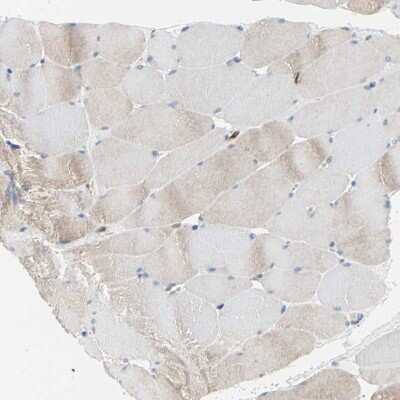 Immunohistochemistry-Paraffin: LRPAP Antibody [NBP1-89334]