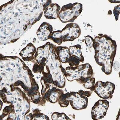 Immunohistochemistry-Paraffin: LRPAP Antibody [NBP1-89334]