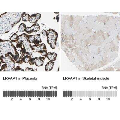 Immunohistochemistry-Paraffin: LRPAP Antibody [NBP1-89334]