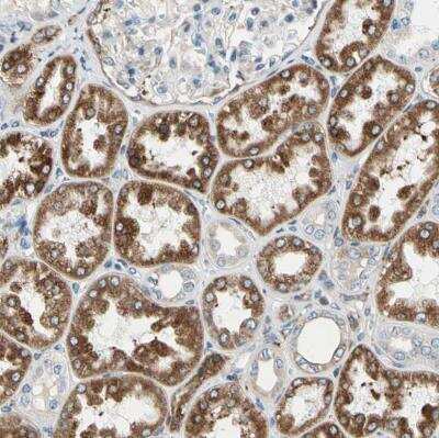 Immunohistochemistry-Paraffin: LRPAP Antibody [NBP1-89334]