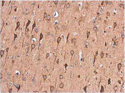 Immunohistochemistry-Paraffin: LRPAP Antibody [NBP2-15088]