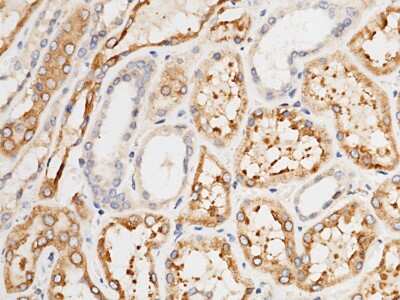 Immunohistochemistry-Paraffin: LRPAP Antibody [NBP2-99704]