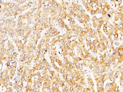 Immunohistochemistry-Paraffin: LRPAP Antibody [NBP2-99704]