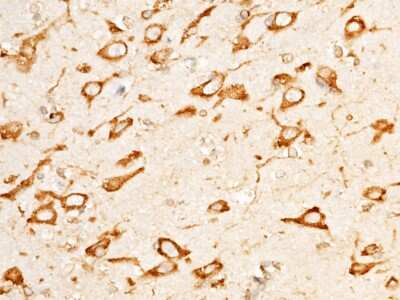 Immunohistochemistry-Paraffin: LRPAP Antibody [NBP2-99704]