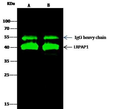 Immunoprecipitation: LRPAP Antibody [NBP2-99704]