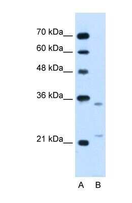 Western Blot: LRPAP Antibody [NBP1-69362]