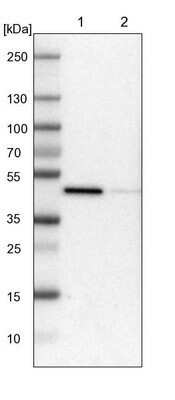 Western Blot: LRPAP Antibody [NBP1-89334]