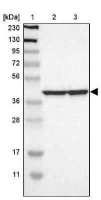 Western Blot: LRPAP Antibody [NBP1-89334]