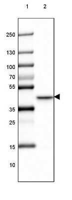 Western Blot: LRPAP Antibody [NBP1-89334]