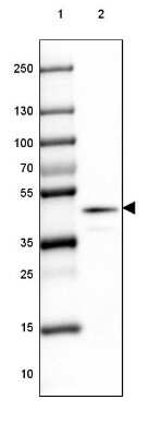 Western Blot: LRPAP Antibody [NBP1-89334]