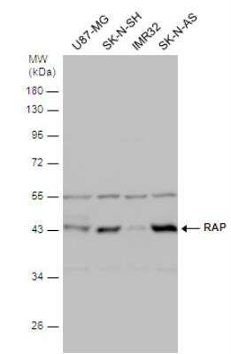 Western Blot: LRPAP Antibody [NBP2-15088]