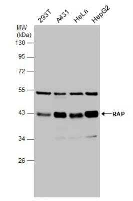 Western Blot: LRPAP Antibody [NBP2-15088]