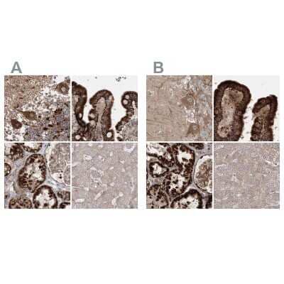 Immunohistochemistry-Paraffin: LRPPRC Antibody [NBP1-83349]