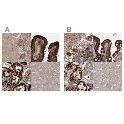 Immunohistochemistry-Paraffin: LRPPRC Antibody [NBP2-38300]