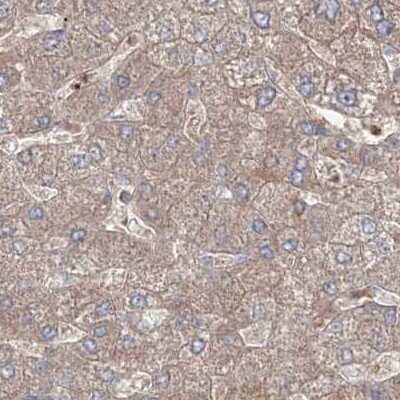 Immunohistochemistry-Paraffin: LRPPRC Antibody [NBP2-38300]