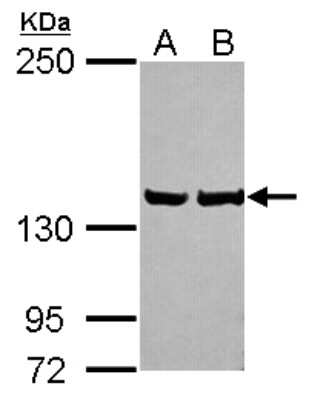 Western Blot: LRPPRC Antibody [NBP2-19373]