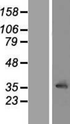 Western Blot: LRRC10 Overexpression Lysate [NBP2-04593]