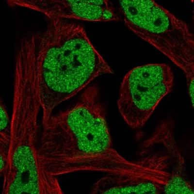 Immunocytochemistry/ Immunofluorescence: LRRC10B Antibody [NBP2-33493]