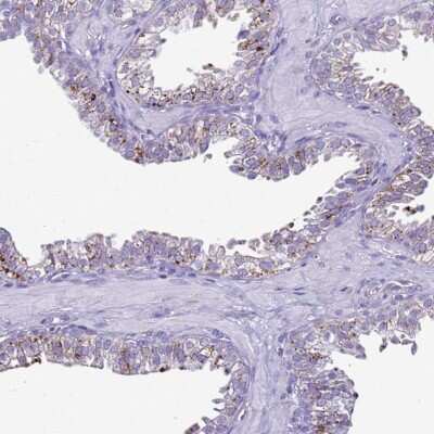 Immunohistochemistry-Paraffin: LRRC10B Antibody [NBP2-33493]