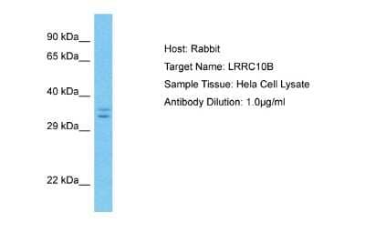 Western Blot: LRRC10B Antibody [NBP2-83149]